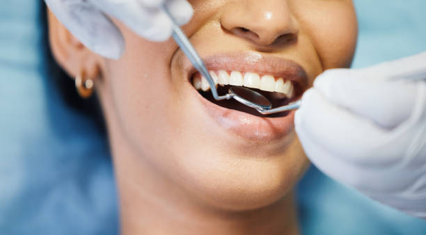 Best Knocked-Out Tooth (Avulsed Tooth) Treatment in Cadott, WI